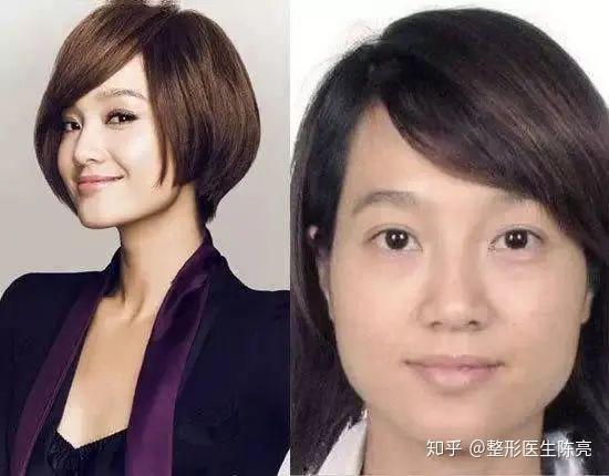 左右脸不对称的明星,揭秘他们独特的魅力之谜